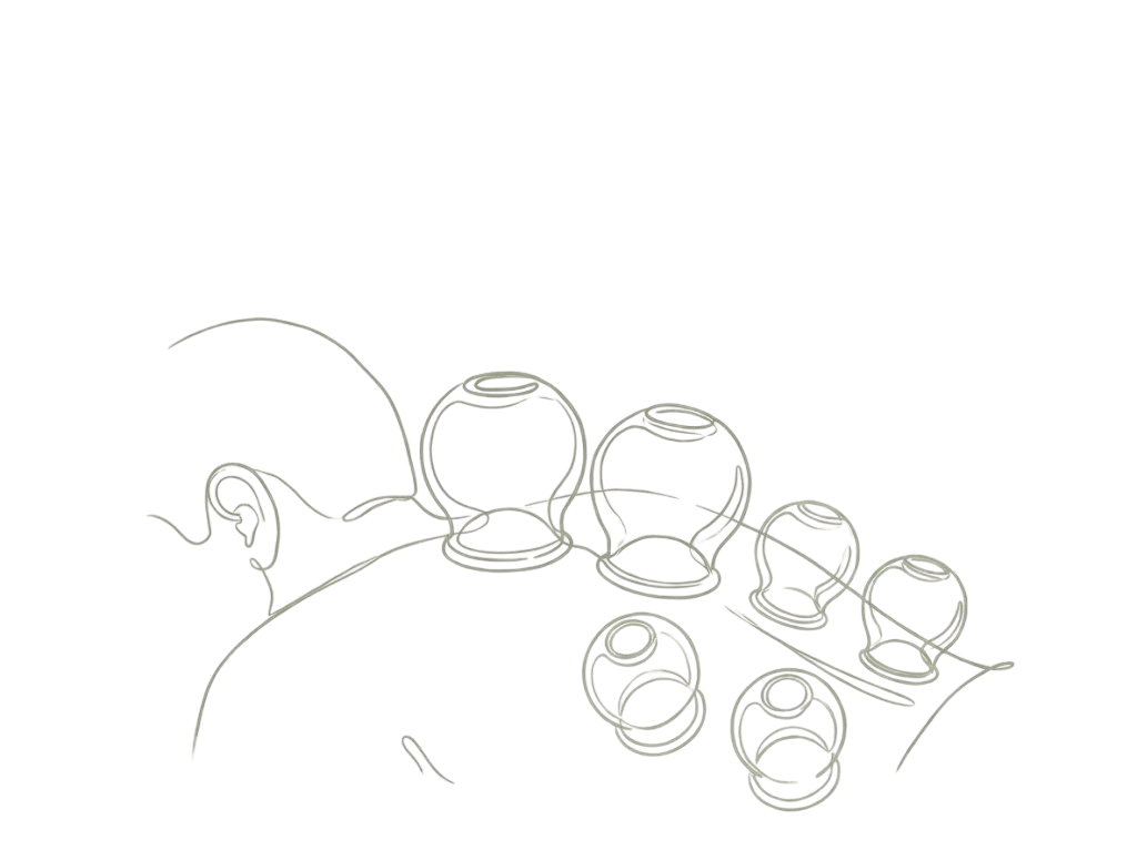 Stawianie baniek ogniowych Wrocław